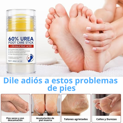 Crema Reparadora de Talones y Pies Hoyrelax