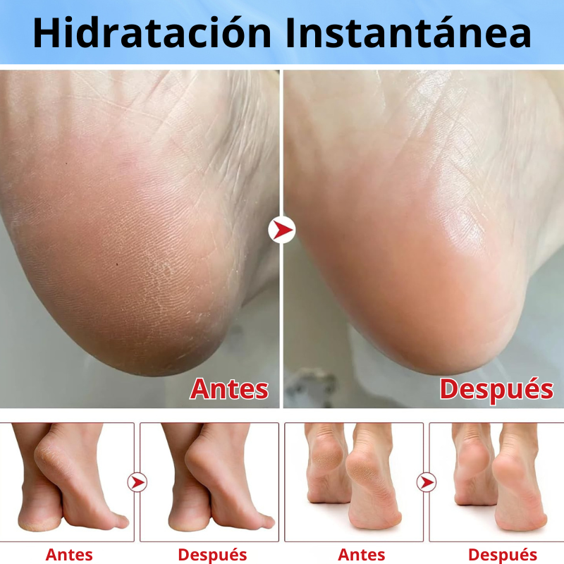 Crema Reparadora de Talones y Pies Hoyrelax